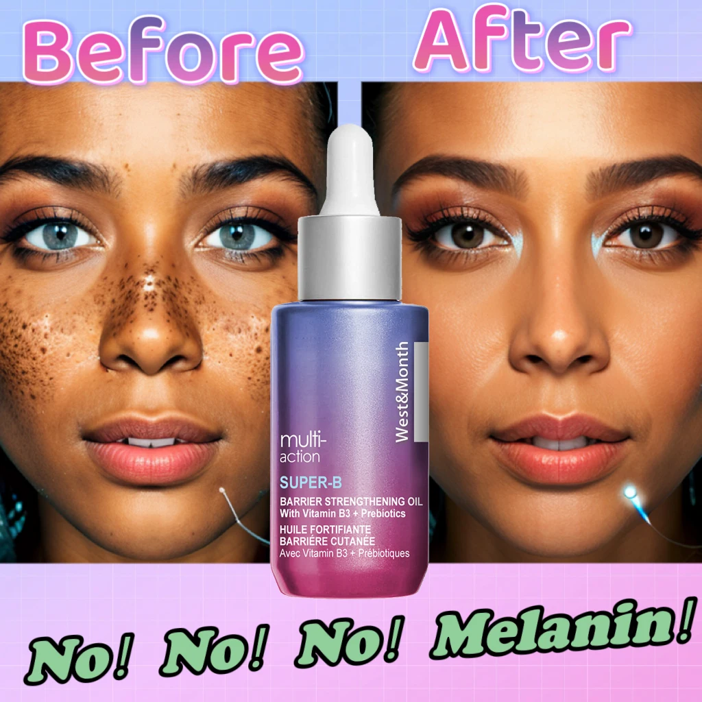 Effective Whitening Freckle Serum Remove Dark Spots Pigment Lighten Melasma Melanin Anti-aging Improve Dullness Facial Skin Care