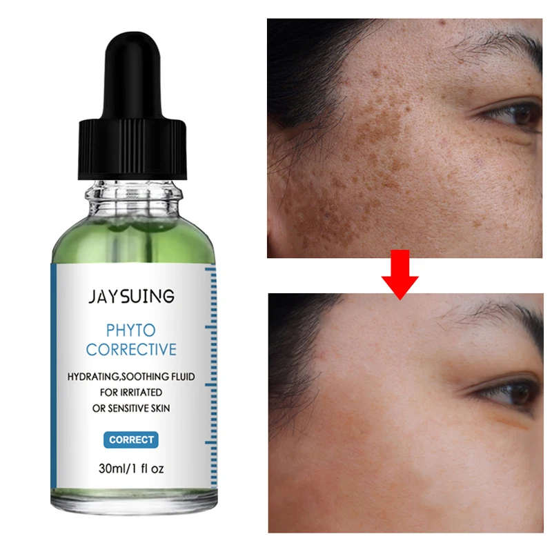 Whitening Face Serum Anti-Freckle Fade Dark Spots Acne Marks Remove Melasma Melanin Brightening Smooth Facial Skin Care Products