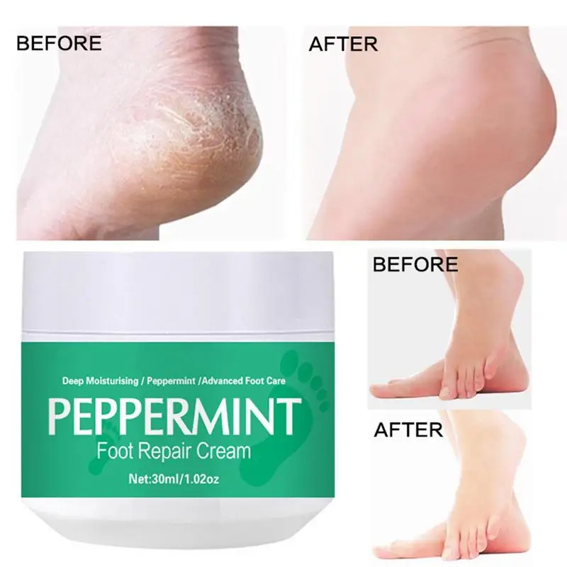 

Anti Crack Foot Cream Moisturizing Anti Drying Crack Foot Hand Cream Heel Cracked Repair Removal Dead Skin Hand Feet Care