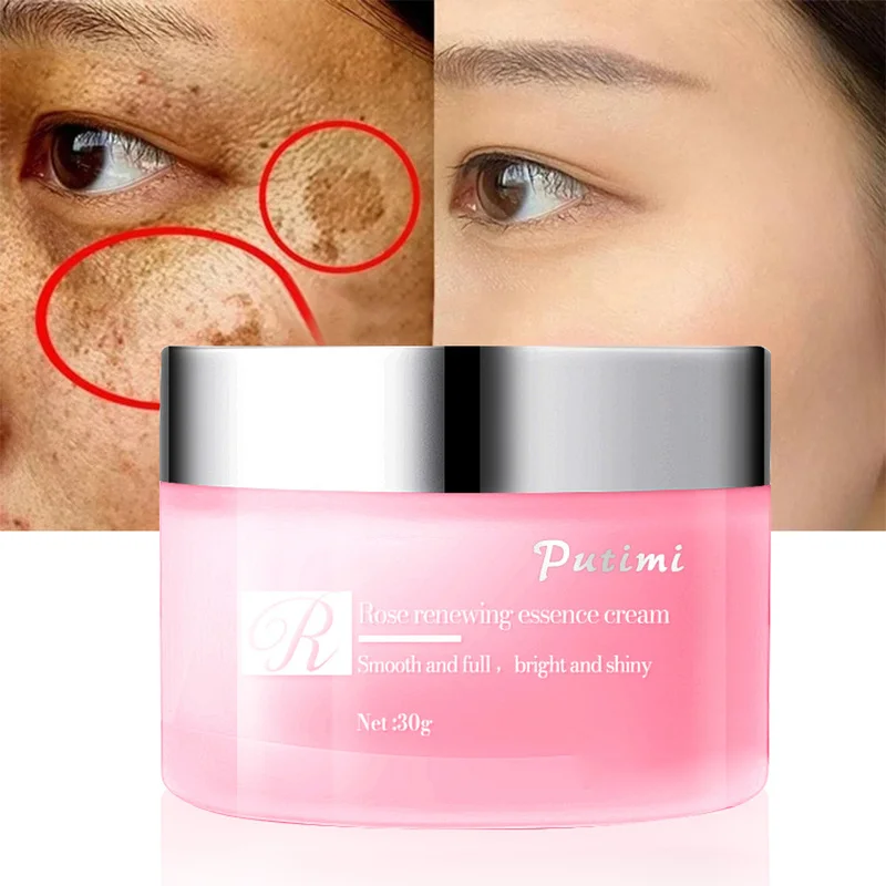 

Отбеливающий крем для лица, Мерцающая сыворотка, от акне, шрамов, меланина, пигментации, мелазмы, антивозрастной, Осветляющий Уход за кожей л...