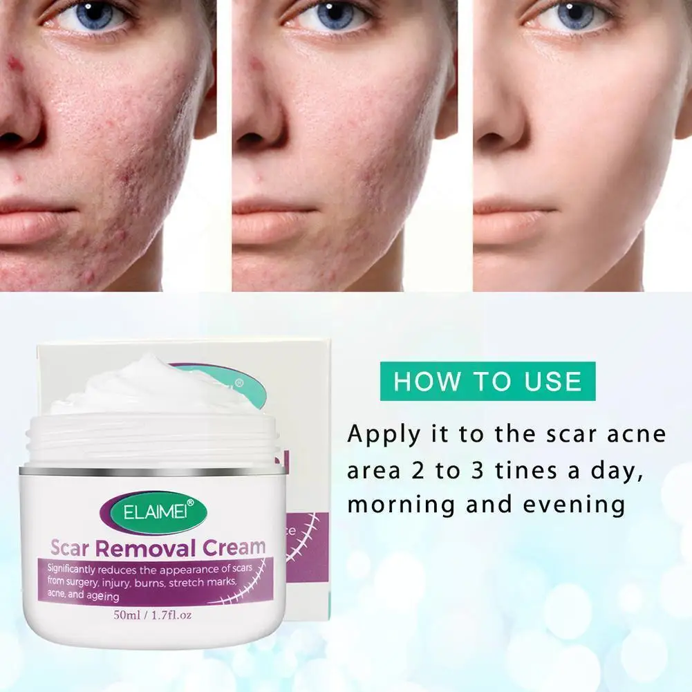 

50ml Scar Removal Cream Moisturizing Stretch Marks Burns Acne Scars Mark Removal Acne Cream Relief Cream Repair Repair V8y4