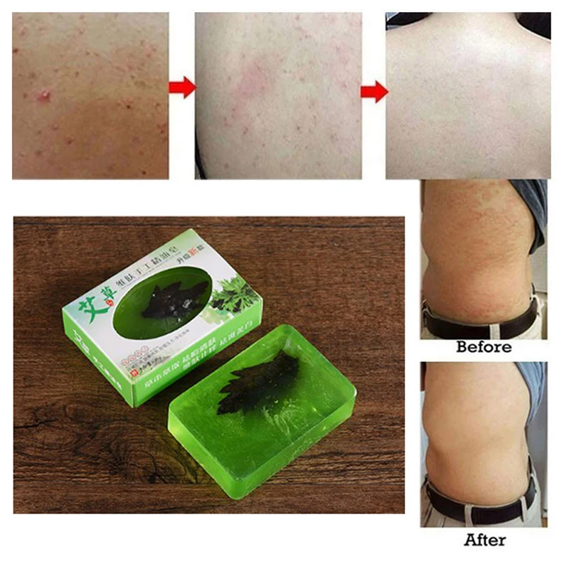 

100g Wormwood Soap For Sensitive Skin Acne Eczema Relieve Itching Cleaning Skin