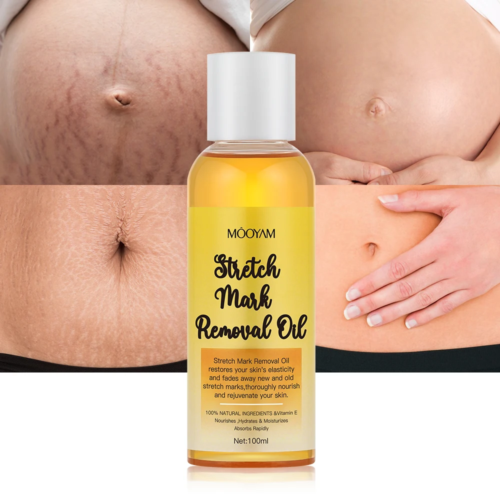 

100ml Stretch Marks Remover Oil Skin Care Treatment Cream For Stretch Mark Removal Maternity Slackline For Pregnant Oils Repair