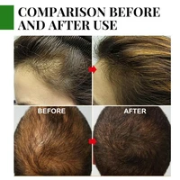 30ml bottled damage free nourishing hair care essential oils original loss liquid for adult hair care oil hair repair oil