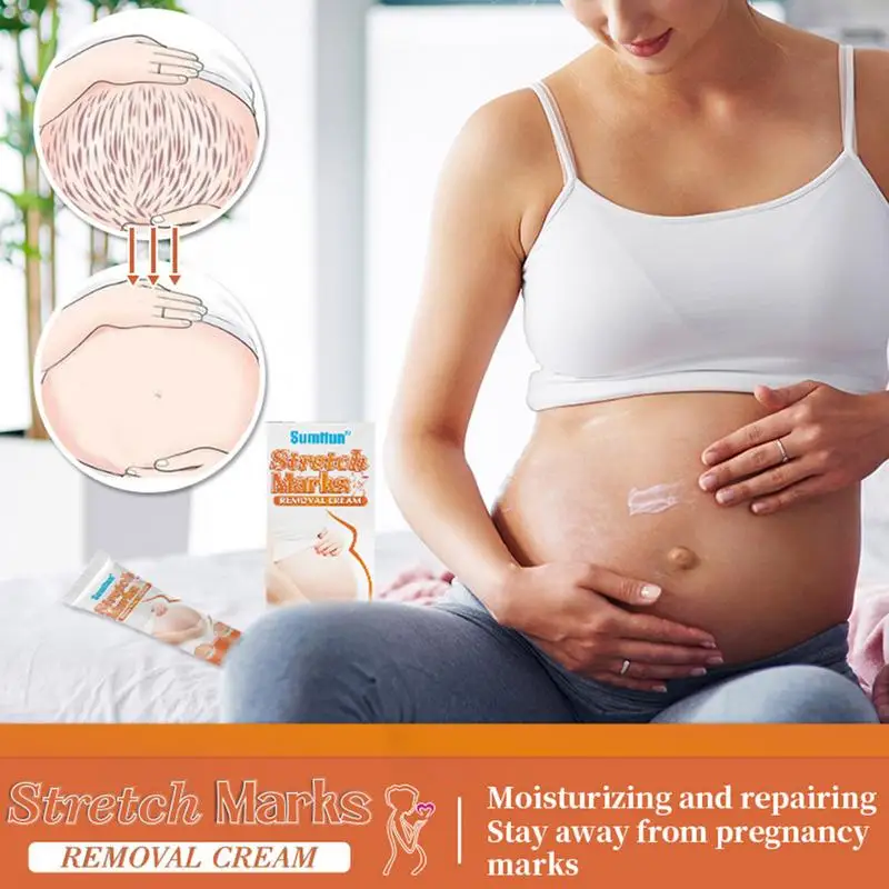 

Крем Для Удаления растяжек, крем для интенсивных рубцов, крем для растяжек, увлажняющий крем для женщин