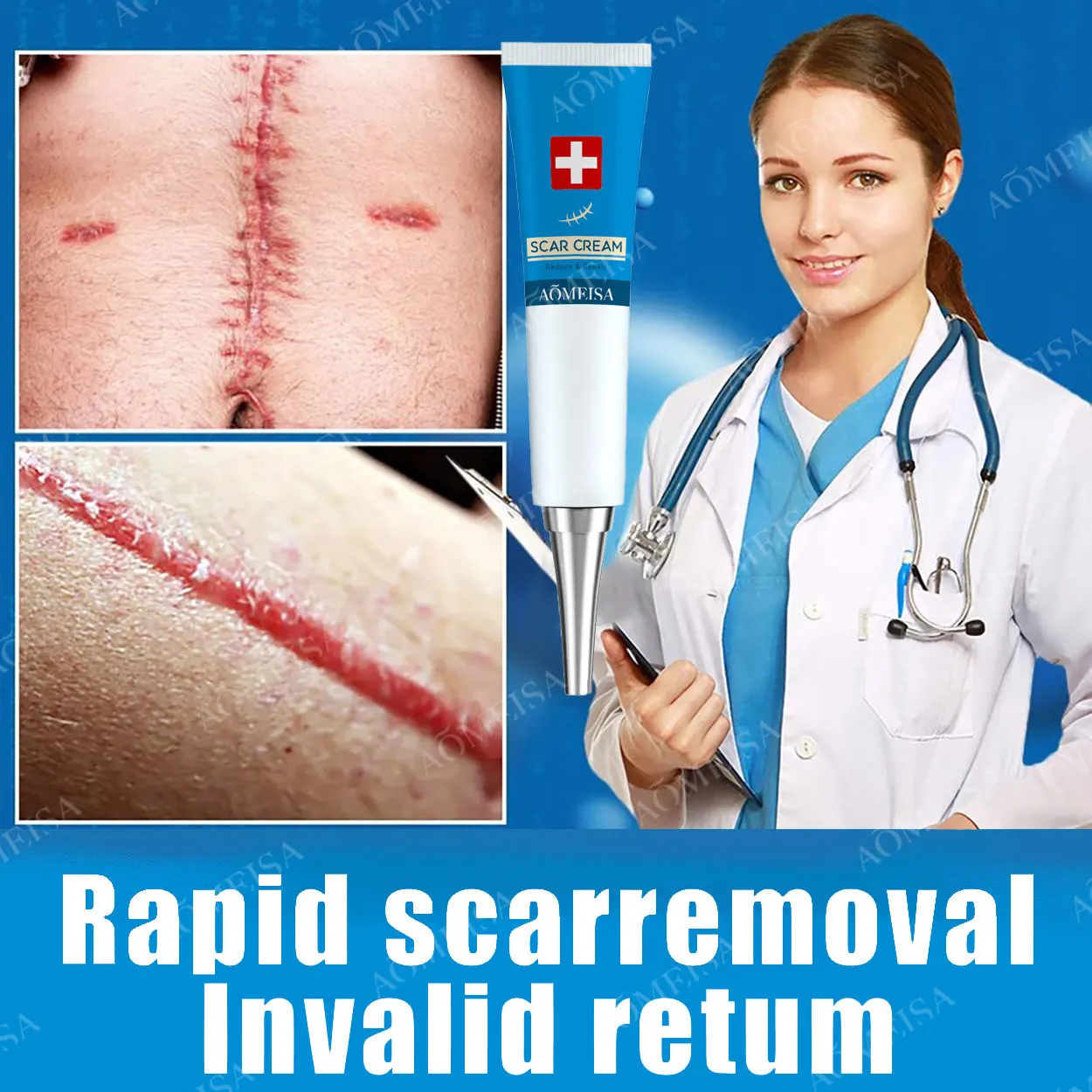 

Scar Removal Cream Scar Repair Gel Fade Scars Burns Caesarean Section Stretch Marks Surgical Scars Hyperplasia Scars