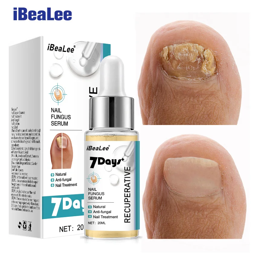 

iBeaLee 7 DAYS Repair Nail Fungus Treatments Essence Foot Anti-Infection Serum Nails Fungal Paronychia Onychomycosis Removal Gel