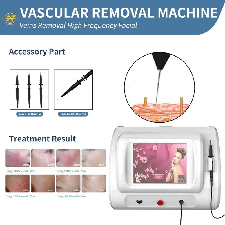 

10W Newest Arrival 980Nm Spider Veins Removal Veins Red Face Removal 980Nm Laser