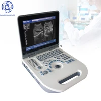 ultrasound machine portable usg scanner in medical instrument