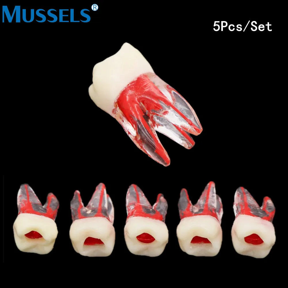 Endo Teeth Root модель канала RCT учебный блок Фотополимерная полость для стоматологии