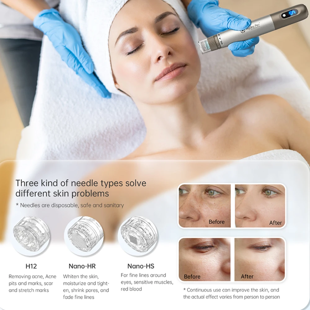 Рисунок 2 - Профессиональный дермапен Hydra Pen H3 с 32 иглами