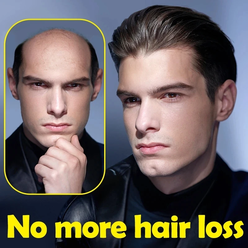 

Oriental Ancient Secret Formula Fast Hair Growth Oil Hair Regrowth Serum Thinning Treatment Hair Ginger Liquid Anti-Hair Loss