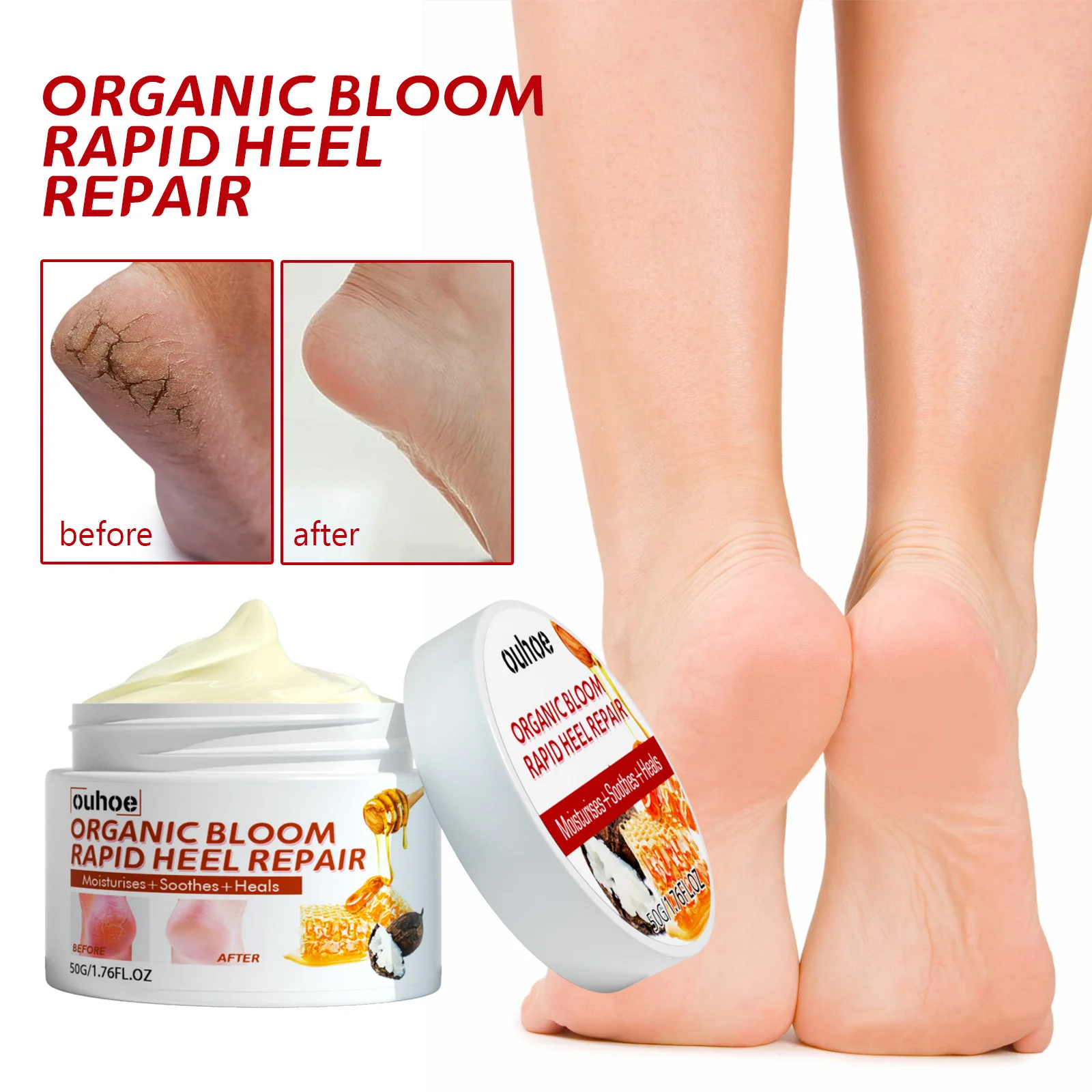 

Effective Anti Crack Foot Cream Anti-Drying Heel Cracked Hand Feet Treatment Remove Dead Skin Moisturizing Repair Beauty Product