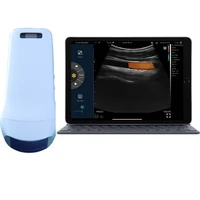 konted 3 in 1 wireless ultrasound probe color doppler ultrasound scanner for whole body examination