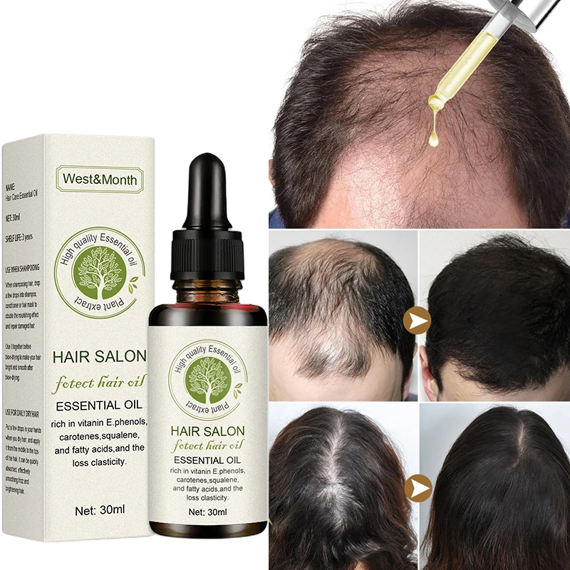 Fast Hair Growth Essential Oil Promotes Thicker Hair Regrowth Anti Hair Loss Effectives Treatment Bald Men Women Hair Care Serum