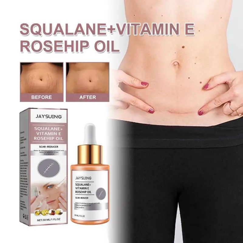 

Repairs Scars Scar Gel Burn And Injury Care Scars Smooths Scars Rosehip Oil Skin Regrowth Burn Care Ointment Burn Care