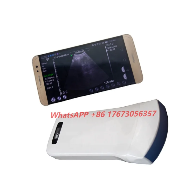 

Wireless Ultrasound Scanner 3.5MHz Wifi Wireless Handheld Pocked Wireless Ultrasound Probe Price