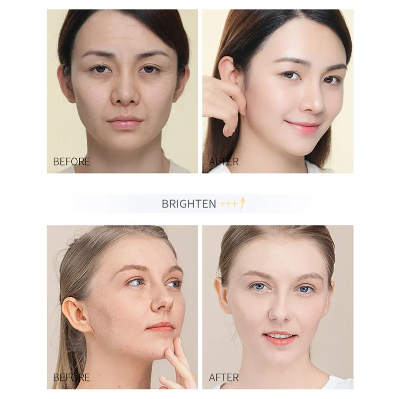 Отбеливающая увлажняющая сыворотка для лица с гиалуроновой кислотой 17 мл -