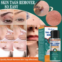 skin tags remover painless mole skin dark spot warts remover serum freckle face wart tag treatment removal cream essential oil