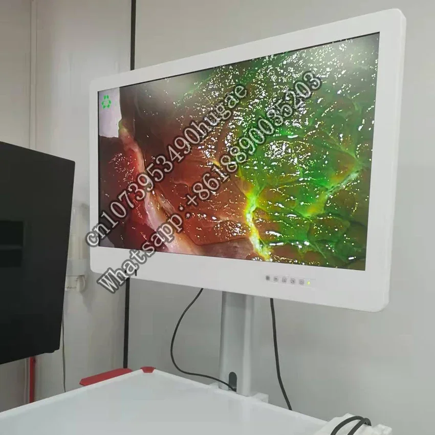 Профессиональные эндоскопические медицинские мониторы 4k 32 дюйма для