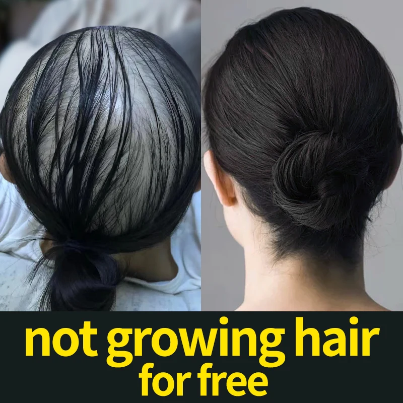 90 дней восстановления волос против выпадения способствует восстановлению роста