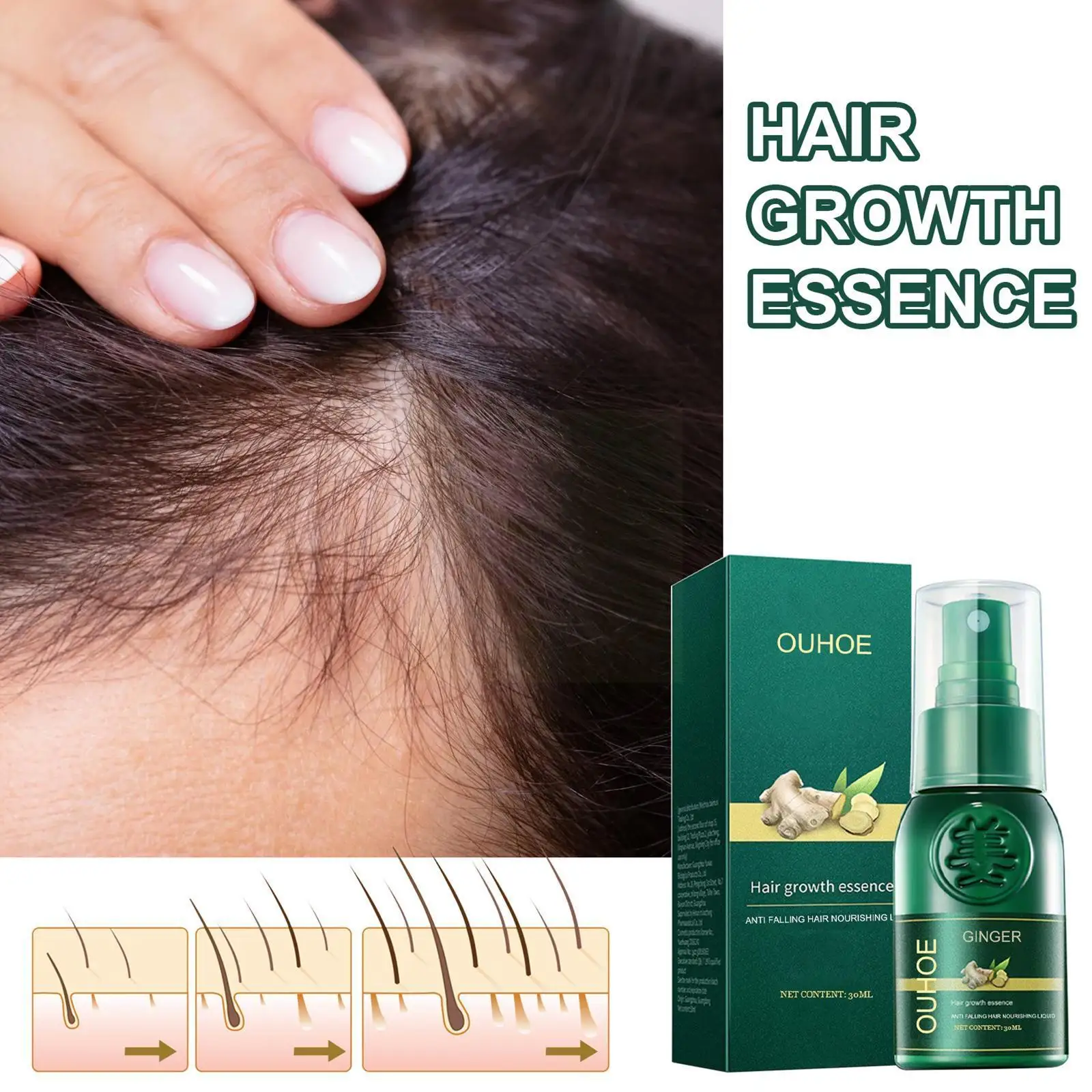 

Ginger Hair Growth Spray Serum For Anti Hair Loss Essential Oil Fast Grow Hair Treatments Dry Damaged Thinning Hair Care Pr L6i4