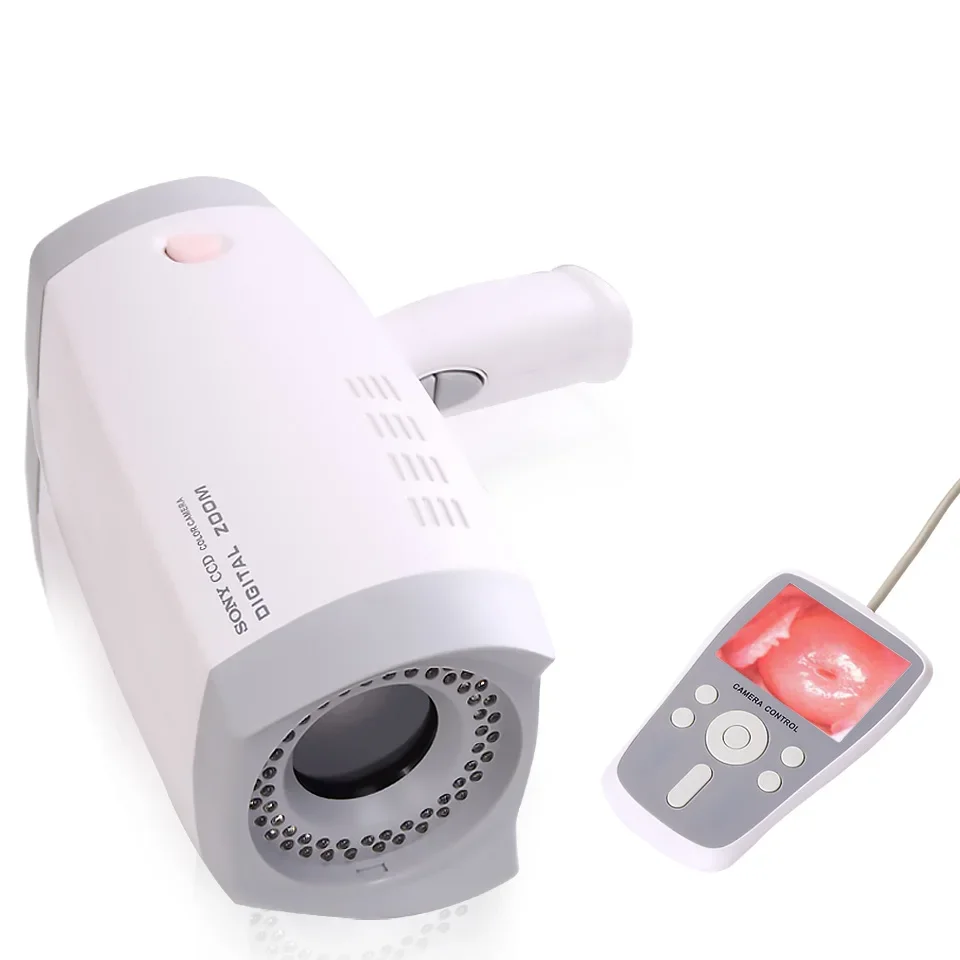 Дешевая цена портативный цифровой видеокольпоскоп электронный кольпоскоп для