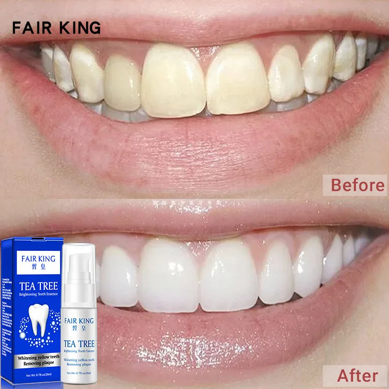 Teeth Whitening Essence Cleaning Oral Whitening Teeth Removal Plaque Aging Stains Fresh Breath Oral Hygiene Bleaching Care