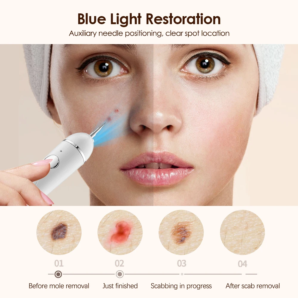Ручка для удаления веснушек и бородавок с ЖК-дисплеем 9 скоростей