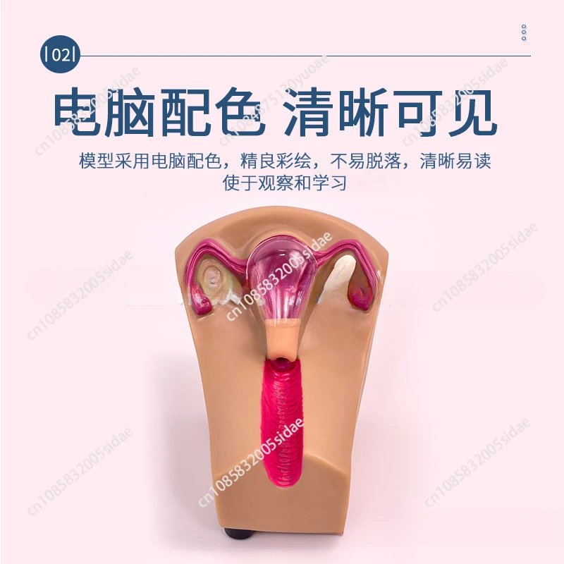 Тренировочный симулятор IUD женское внутриутеринское контрацептивное устройство