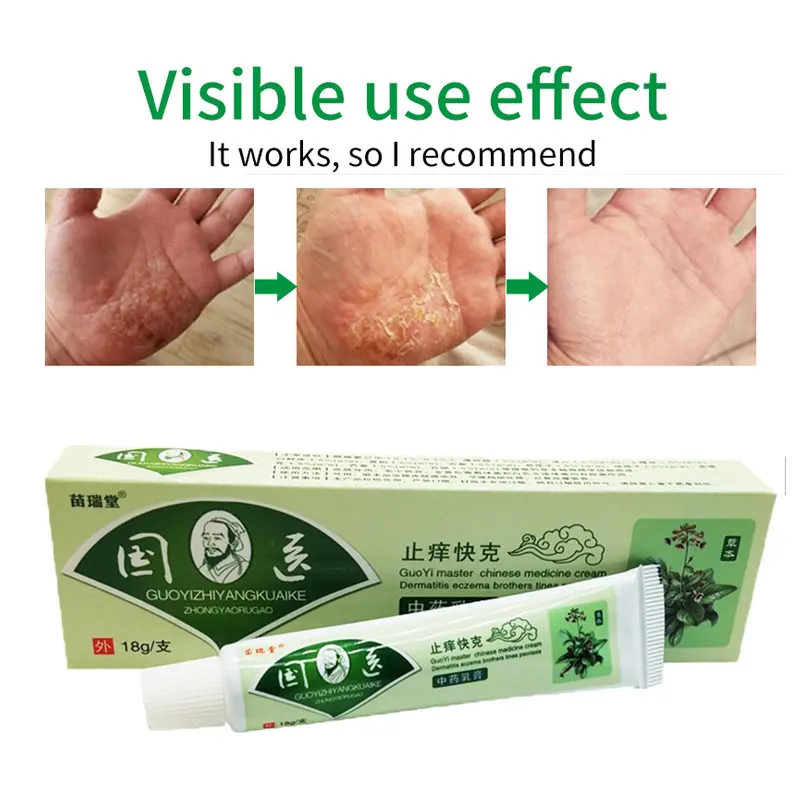 

China's Secret Recipe Herbal Extract Useful Psoriasis Ointment Skin dermatitis cream Eczema Anti-itch Skin Repair Cream