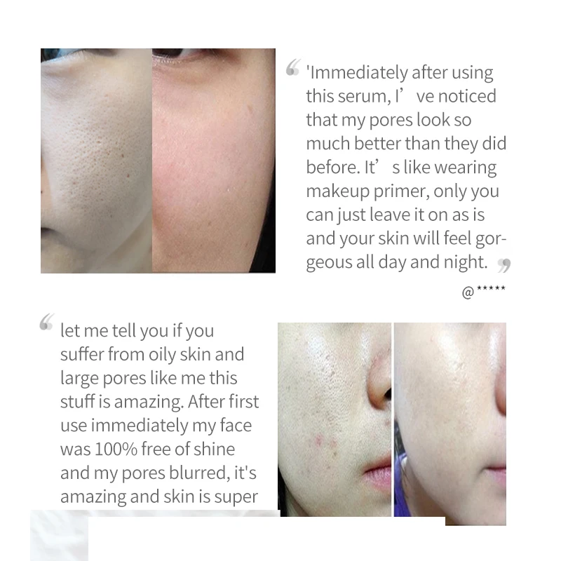 Сыворотка для контроля пор Pro Skincare сужает поры и подтягивает кожу очищает 10 мл/0 34