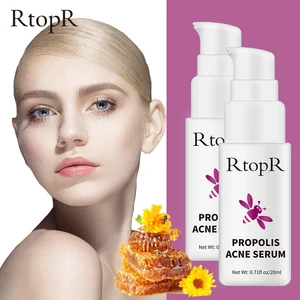 2 шт RtopR прополиса контроль масла акне сыворотка ремонт акне шрам Очищающая сыворотка усадка лечение акне, увлажнение