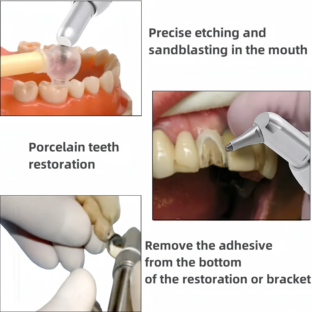 Микропластер из оксида алюминия с водяным распылением Микроотбойник