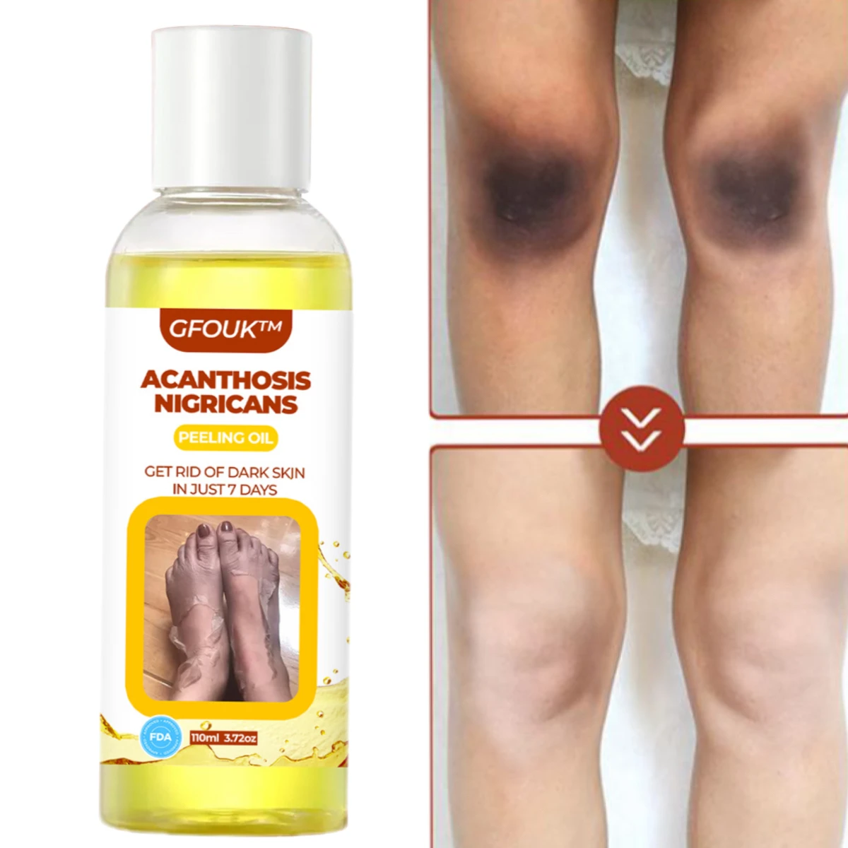 

110ml Yellow Peeling Oil Bleaching Dark Skin Lighten Elbows Knees Hands Melanin Even Tone Effective Whitening Body Care Serum
