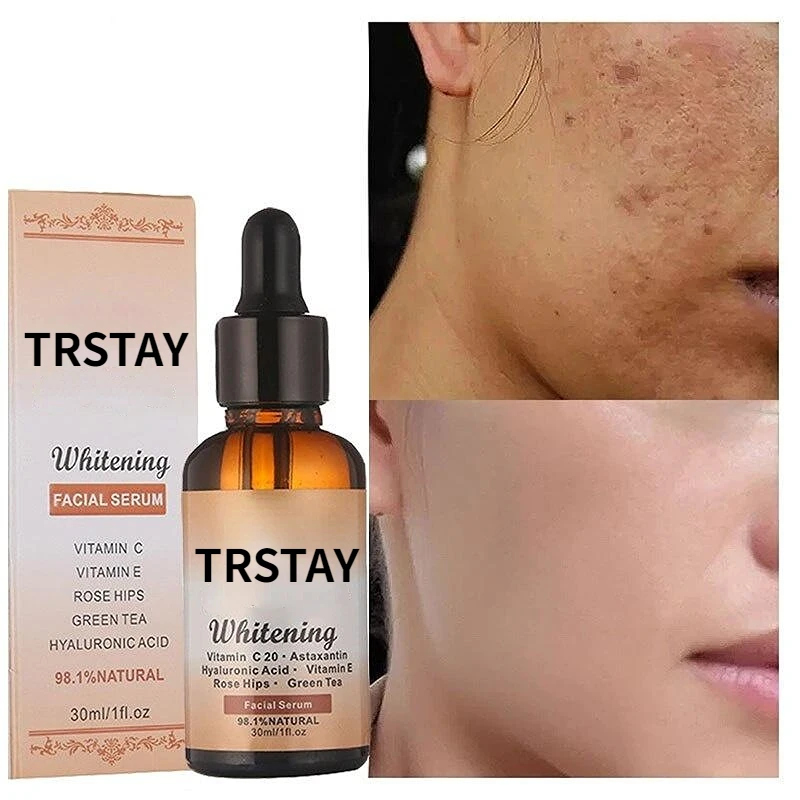 

Face Essence essential Oils Anti Wrinkle Anti-aging Lighten Spots Brightening Facial Skin Fade Remove Freckle Speckle Care