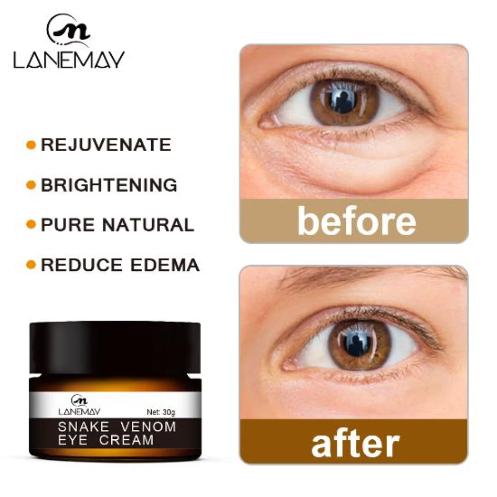 

Anti-Wrinkle Eye Cream Collagen Anti-Dark Circles Anti-Aging Gel Hyaluronic Acid Anti-Puffy Eye Bags