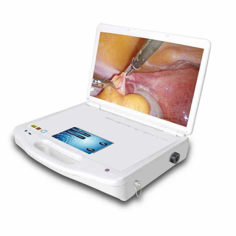 

Portable led monitor Full HD 1080P endoscope ent Endoscopy camera machine GW603