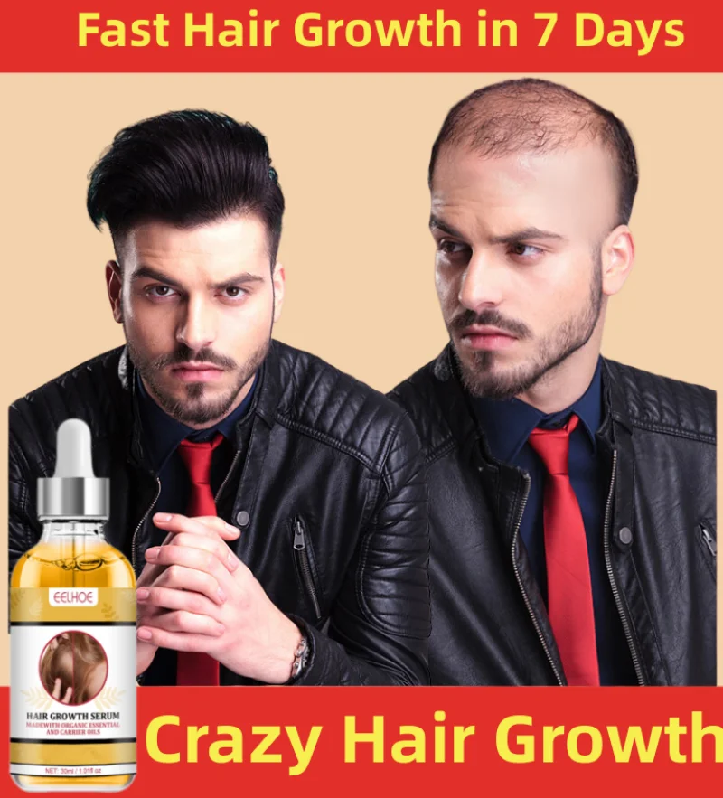 

Powerful Hair Growth Serum Anti-Hair Loss Hair Follicle Treatment Anti-Baldness Alopecia Seborrheic Fast Hair Regrowth Oil