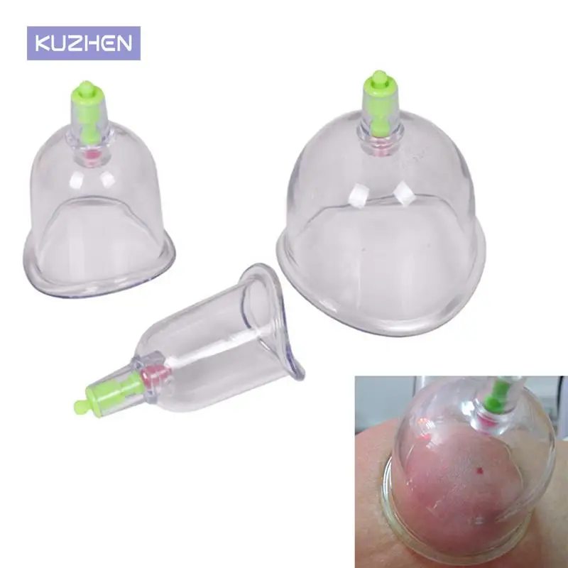 

3pcs Traditional Cupping Therapy Cups Effective Healthy Chinese Medical Vacuum Cupping Suction Therapy Device Body Massager
