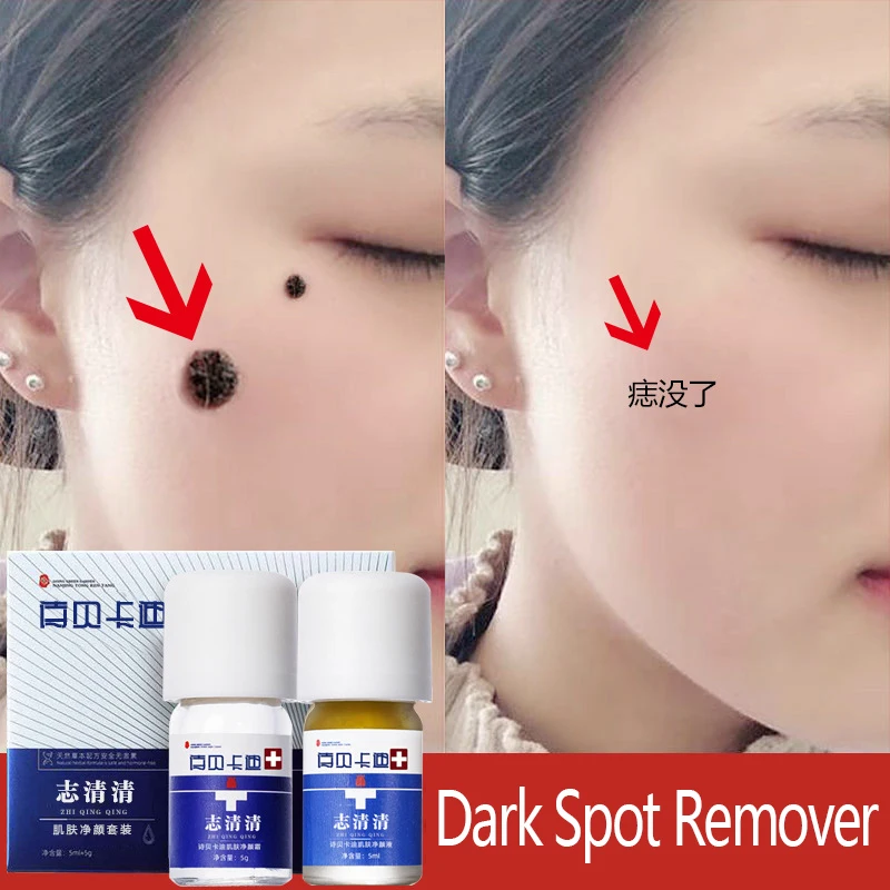 Dark Spot Remover Mole Remover Freckle Removal Skin Tag Remover Cream Repair Serum Set Face Care Products Effective Painless