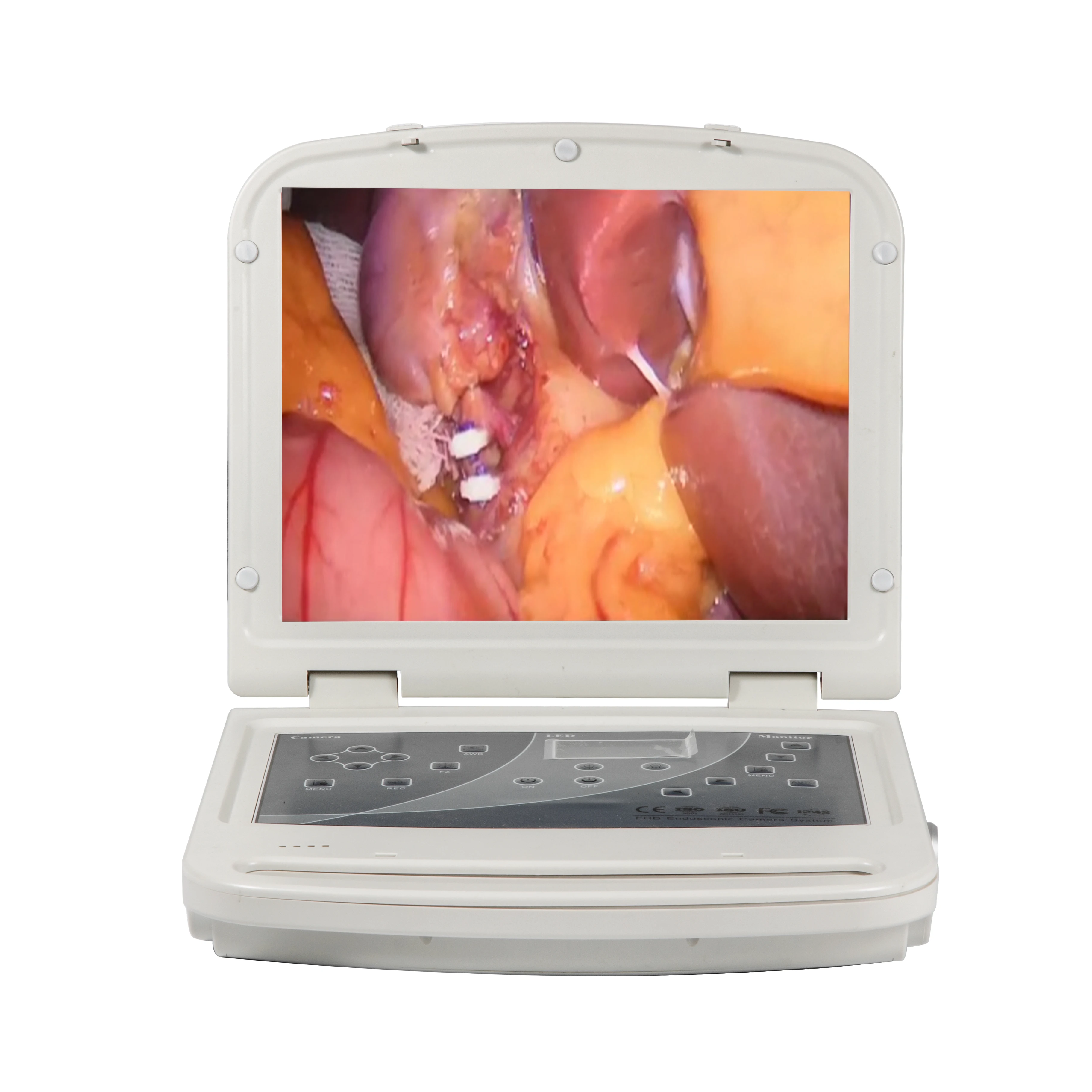 Эндоскопические камеры для ладоскопа Full HD/оборудование эндоскопии