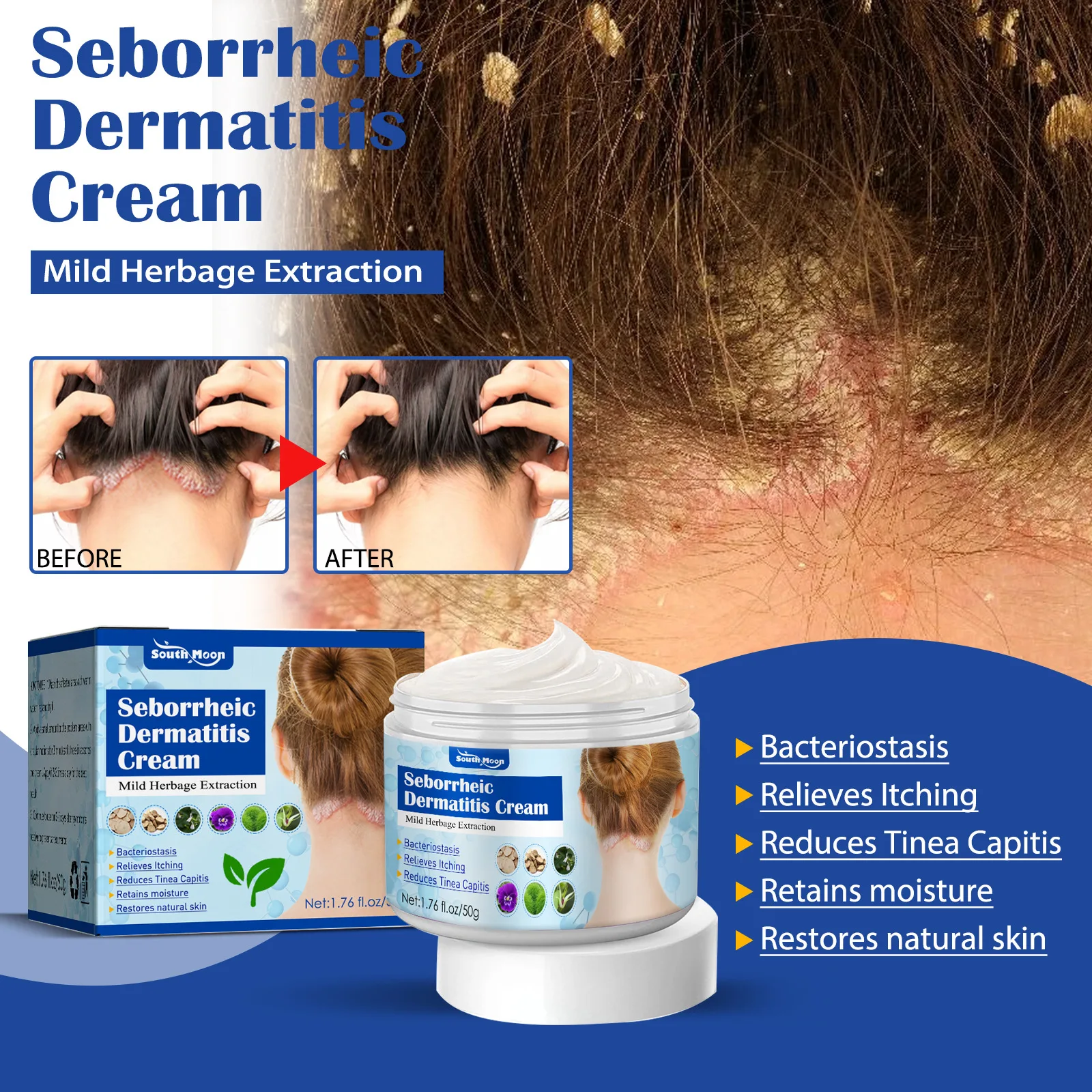 

Seborrheic Psoriasis Itching Relief Cream Antibacterial Pain Repair Scalp Ringworm Treatment Inner Thigh Itchings Topical Unisex
