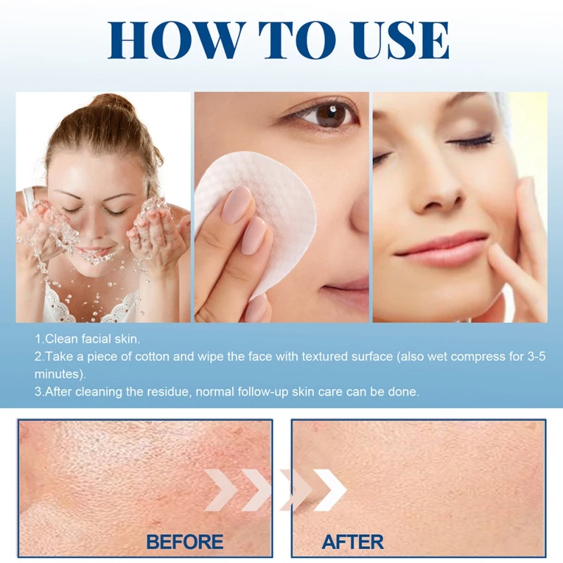 Подушечки для лечения акне и предотвращения жирных сочетаний прыщей на коже