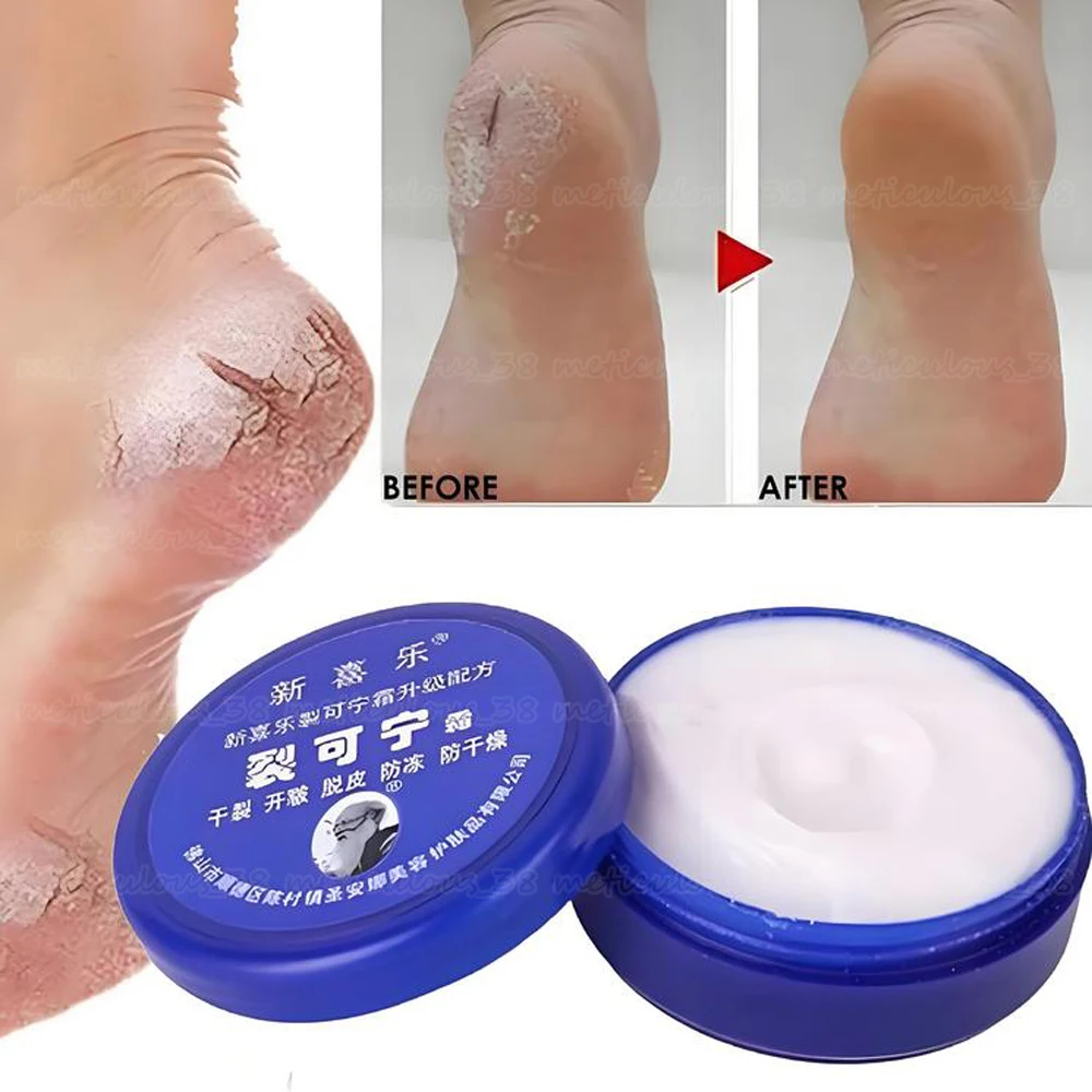 Традиционное китайское масло крем для ног против высыхания трещин