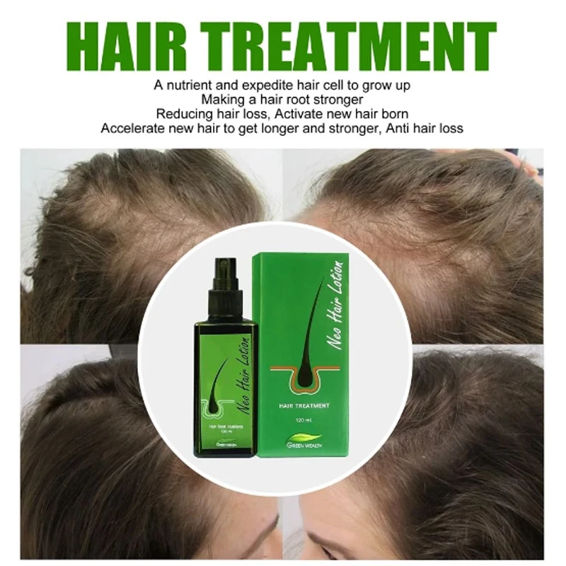 

Neo Hair Lotion 100% Natural Treatment Unisex Herbs Spray Anti Hair Loss Root Beard Sideburns Longer Hair Regrowth Spray 120ml