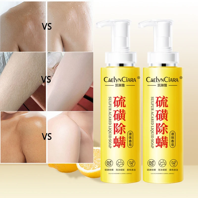 

Очищающее жидкое мыло с серными клещами, 500 мл, антибактериальное средство против зуда и акне, мягкое очищающее средство для ухода за кожей