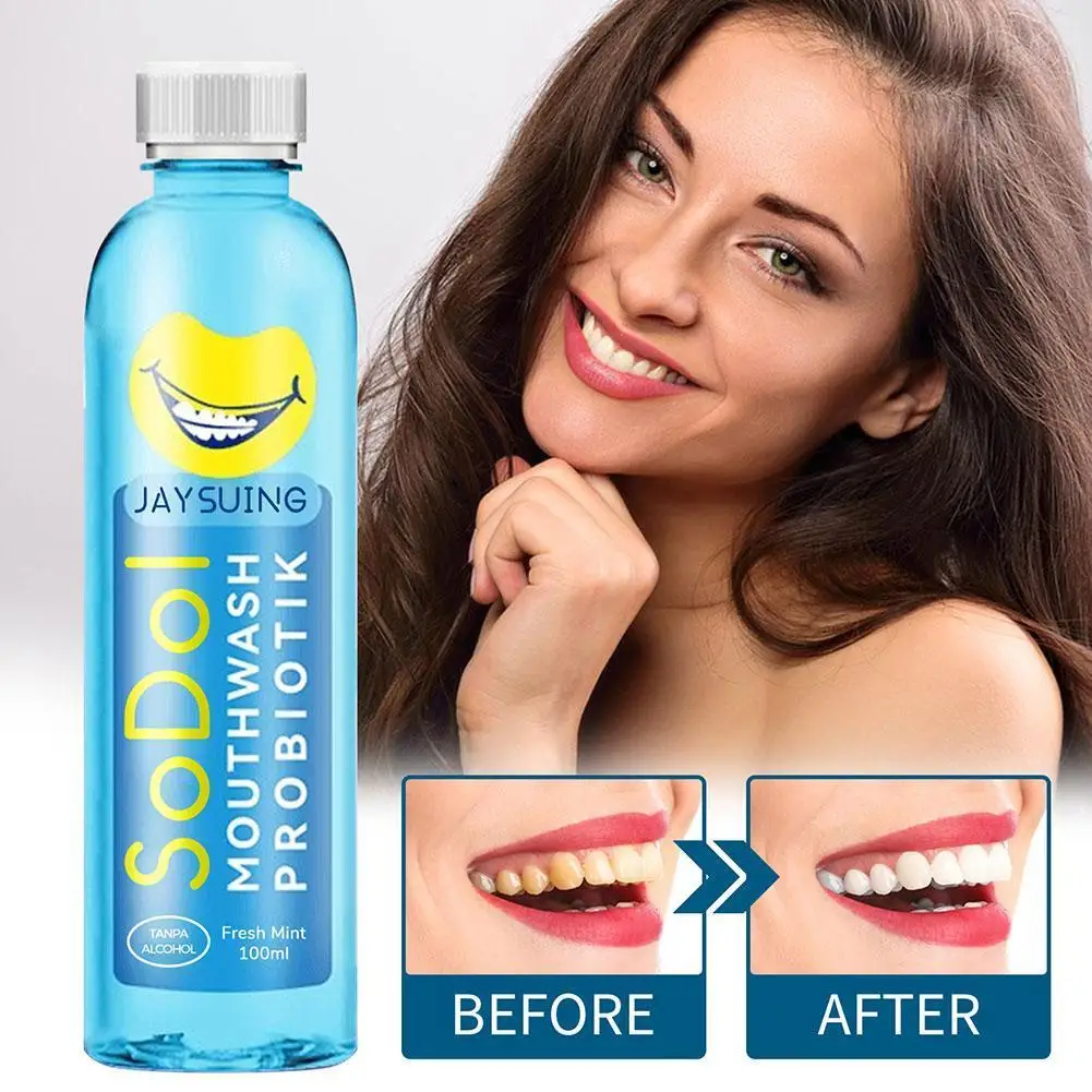 

100ml Portable Relieve Toothache Concentrated Mouth Remove Mouthwash Cleaning Bad Stains Wash Odor Hygiene Breath N2R8