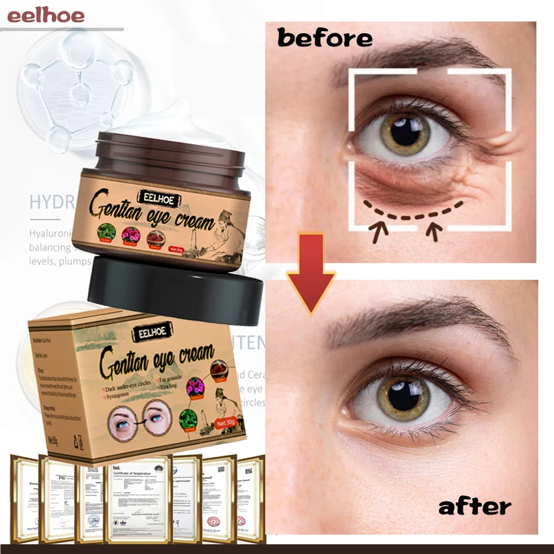 

Anti-Wrinkle Eye Cream Anti-Dark Circles Eye Serum Remove Eye Bags Fatty Grains Anti-Aging Firming Eye Skin Care