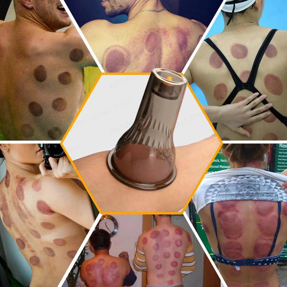 6-х баночный вакуумный набор для скребков тела массажер с подогревом на присоске